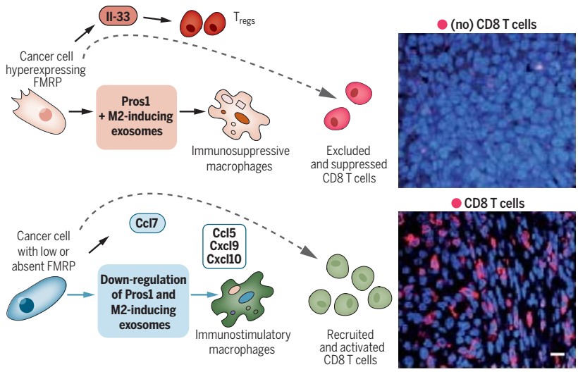 FMRP enables tumors to evade being attacked by the immune system.